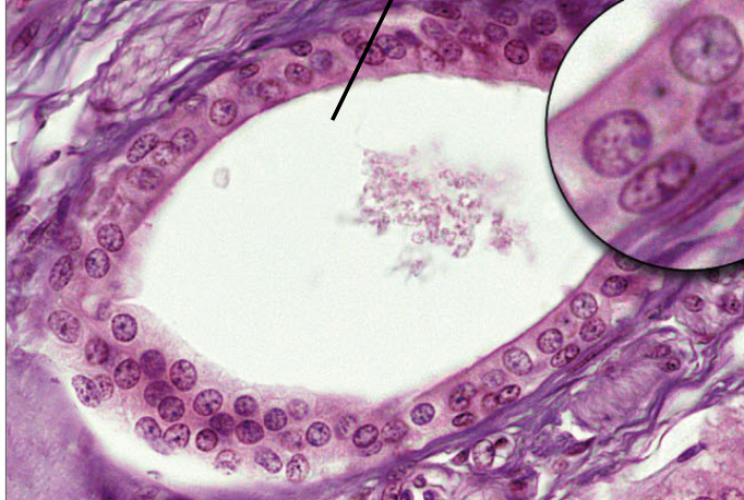 term image