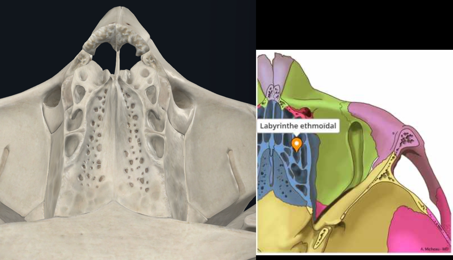 <p>Dans les cellules ethmoïdales</p>