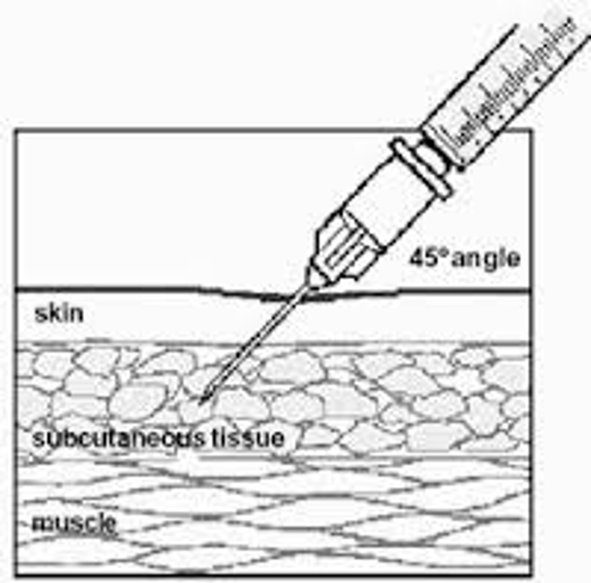 <p>- fluid maintenance = meeting body requirements</p><p>- oral intake (eating/tube feeding), IV infusion, SC infusion (erg. palliative care)</p>
