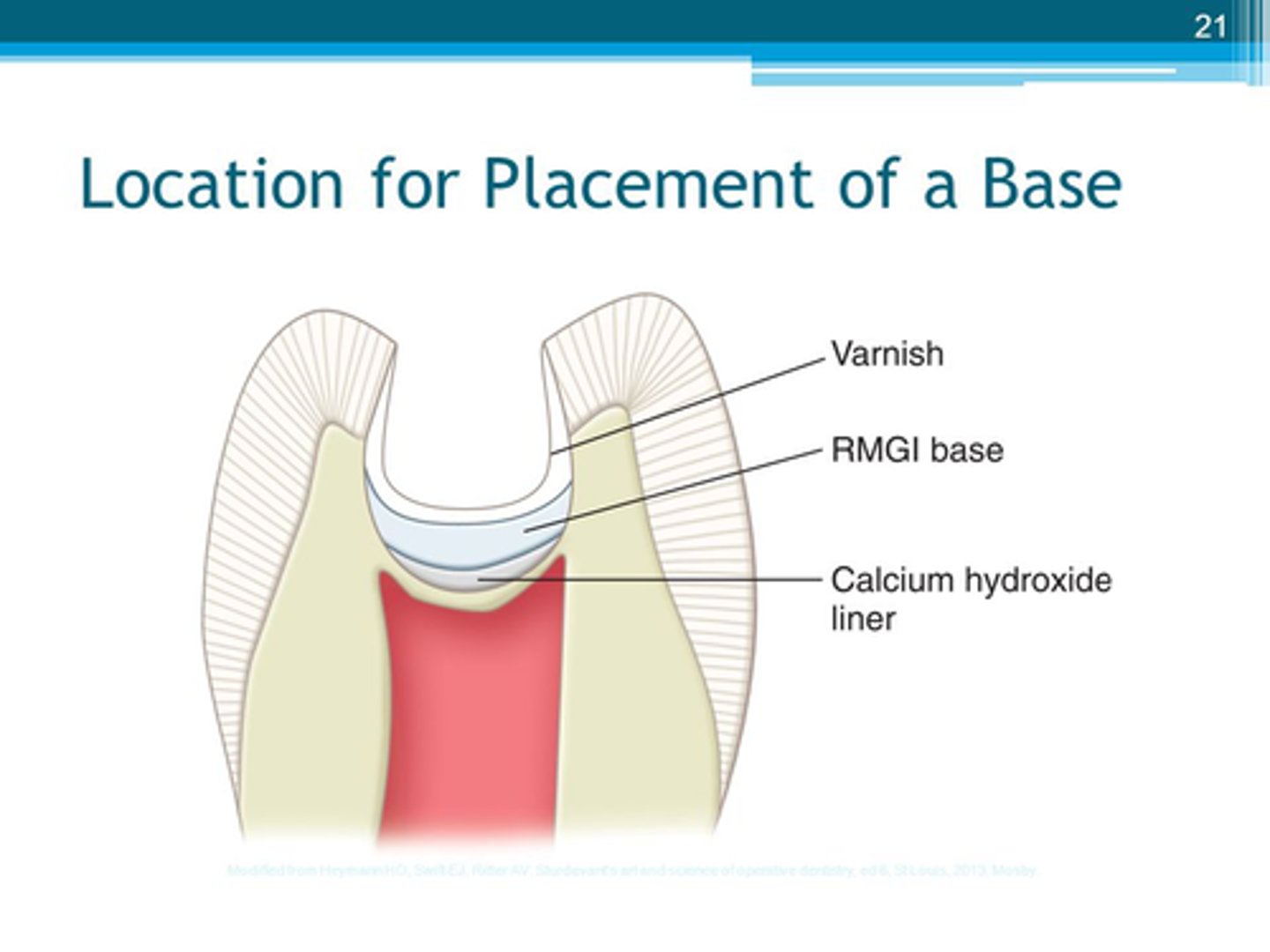 <p>Restorative materials &amp; their functions:</p><p>Cavity liners= (3)</p><p>Cavity bases= (4)</p><p>Cavity sealers= (1)</p><p>-know</p><p>- Cavity liners &amp; bases are used to protect &amp; recent damage the pulp</p>