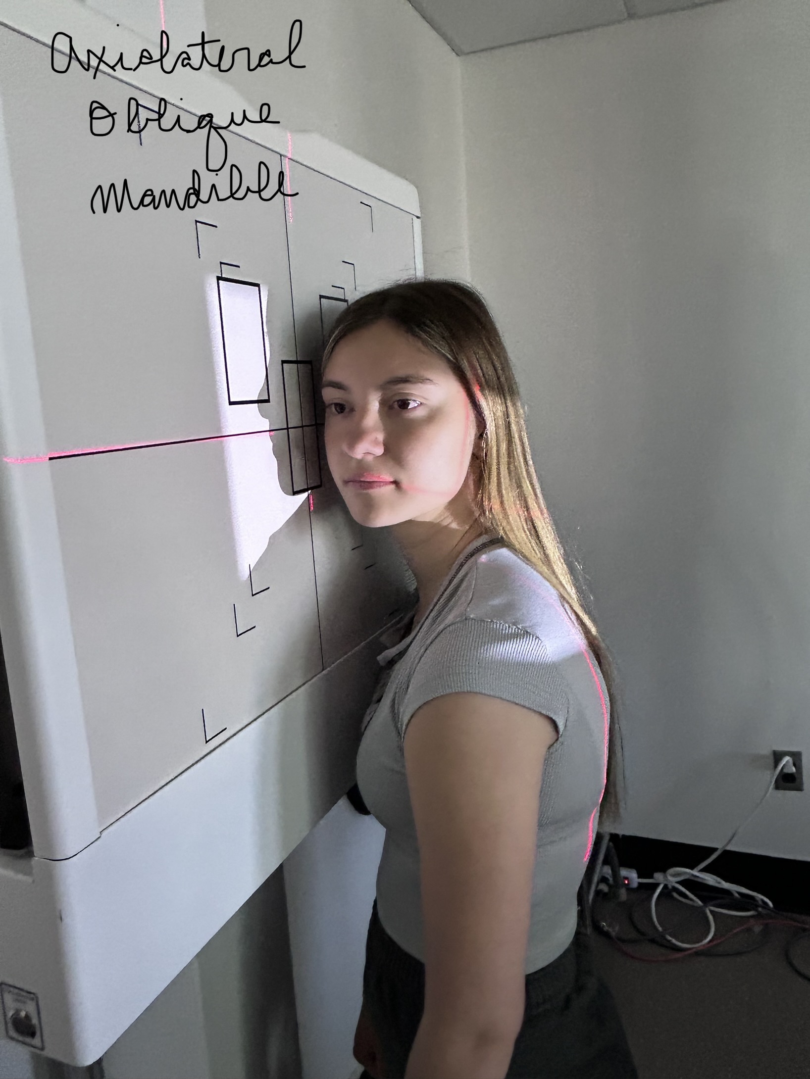 40” SID, 8” x 10” cw collimation, STANDING, 25º cephalic angle, head in true lateral, IPL perpendicular, entering through gonion, exiting through ramus closest to IR