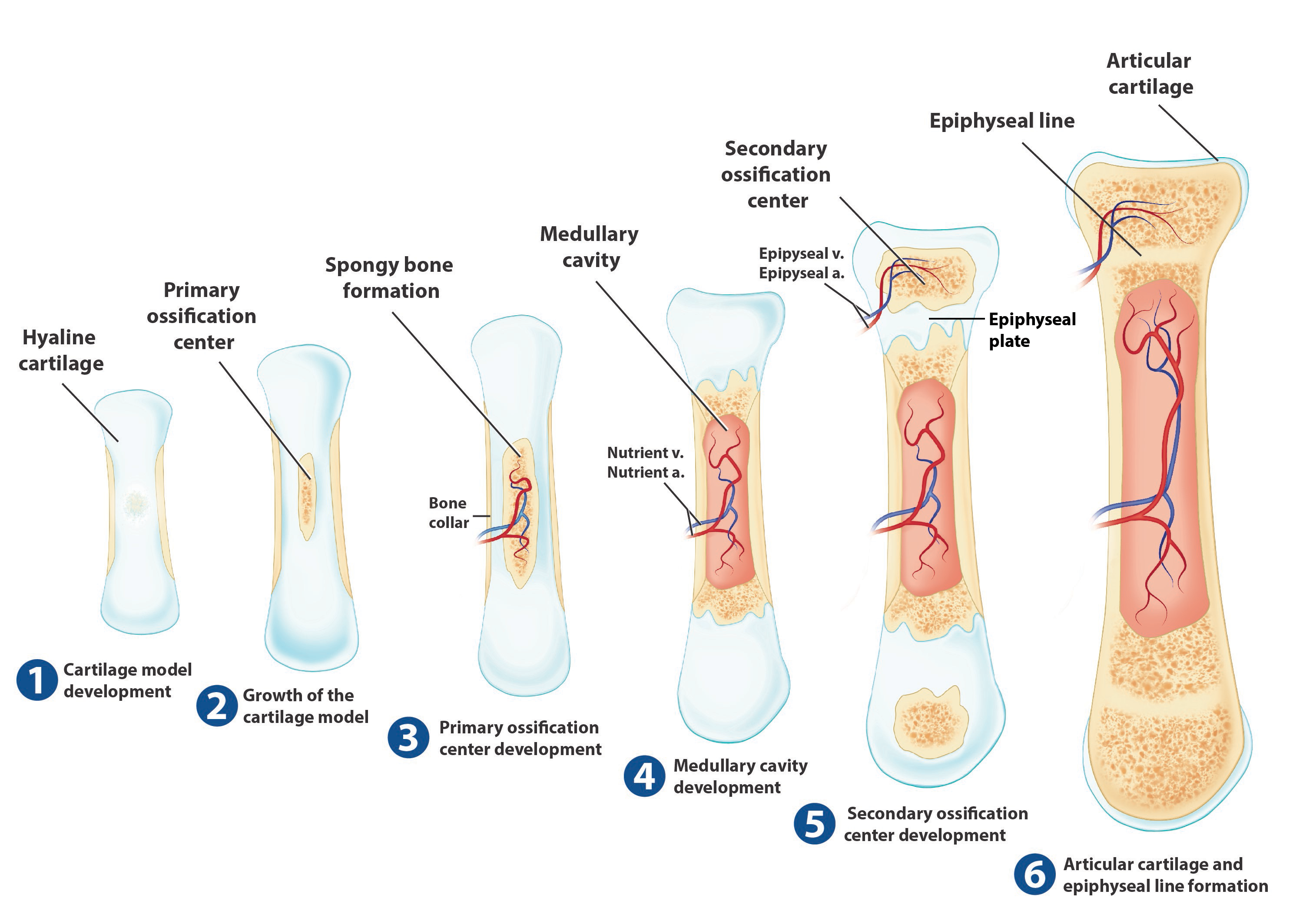 <ol><li><p><strong>Start with cartilage</strong>: A model made of hyaline cartilage forms the shape of the future bone.</p></li><li><p><strong>Cartilage growth</strong>: Cartilage cells grow larger (hypertrophy) and multiply.</p></li><li><p><strong>Calcification begins</strong>: Lime salts make the cartilage hard but not yet bone.</p></li><li><p><strong>Bone-forming cells appear</strong>: Cells beneath the outer layer (perichondrium) turn into osteoblasts, forming a thin layer of bone (bony collar).</p></li><li><p><strong>Blood vessels invade</strong>: Blood vessels grow into the bone, bringing nutrients and creating space for bone marrow.</p></li><li><p><strong>Replace cartilage with real bone</strong>: Minerals like calcium replace the lime salts, turning the hard cartilage into bone.</p></li></ol><p></p>