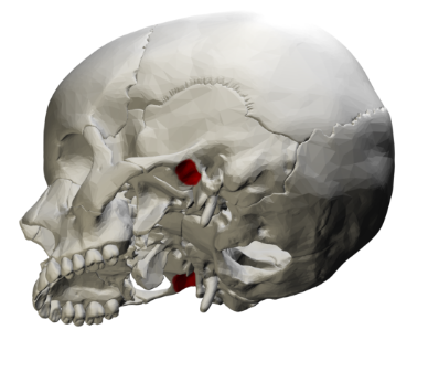 term image