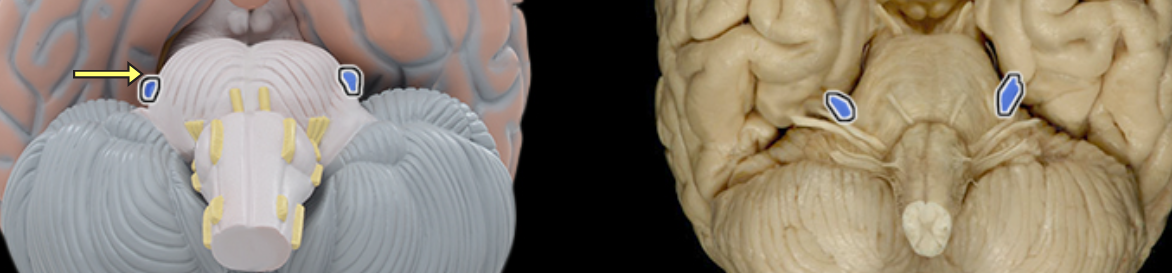 <p>Trigeminal n. (CN V)</p>