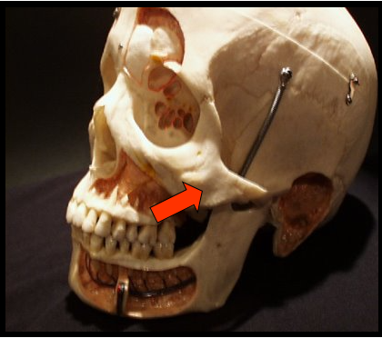 <p>The cheekbone and it articulates with the zygomatic process of the maxilla.</p>