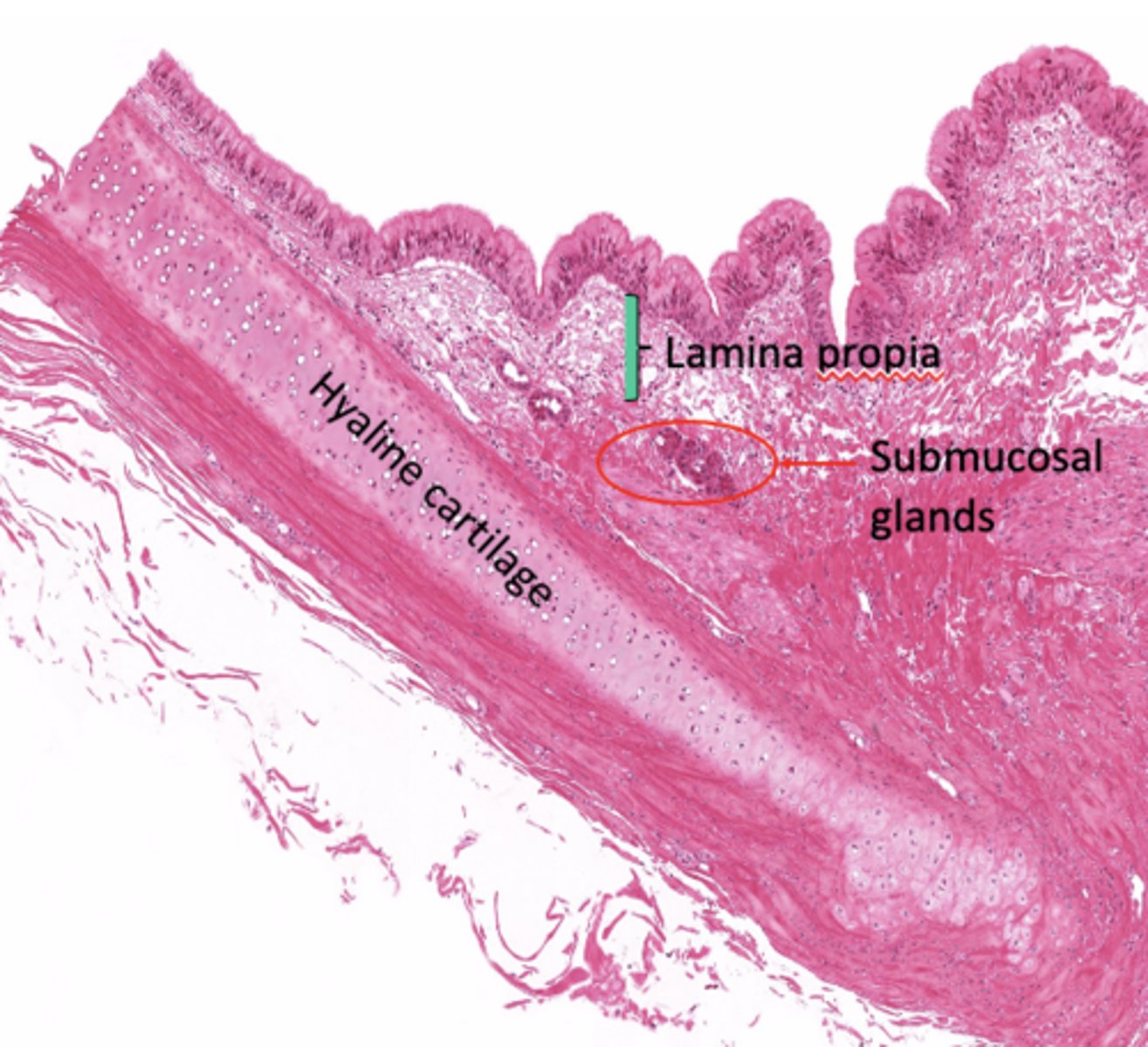 <p>Dense irregular CT and glandular elements.</p>