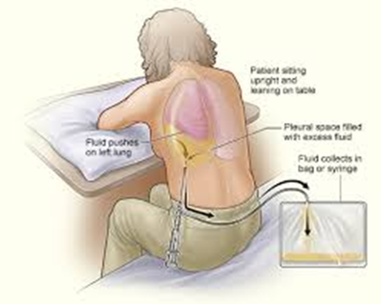 pt sits at edge of the bed and leans forward or on the side