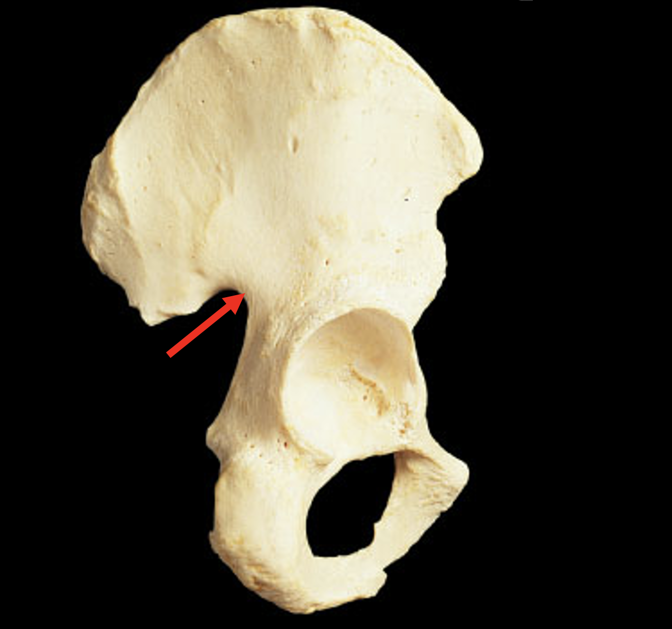 Name this region of the pelvis