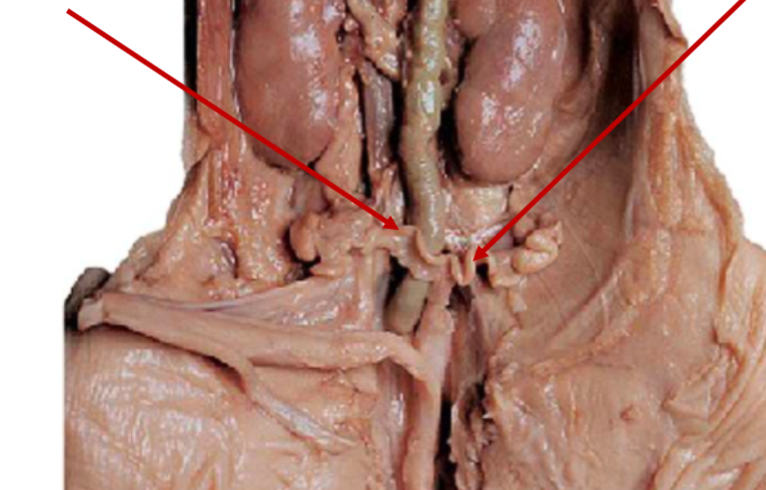 <p>What is the arrow pointing to? What’s it function? </p>