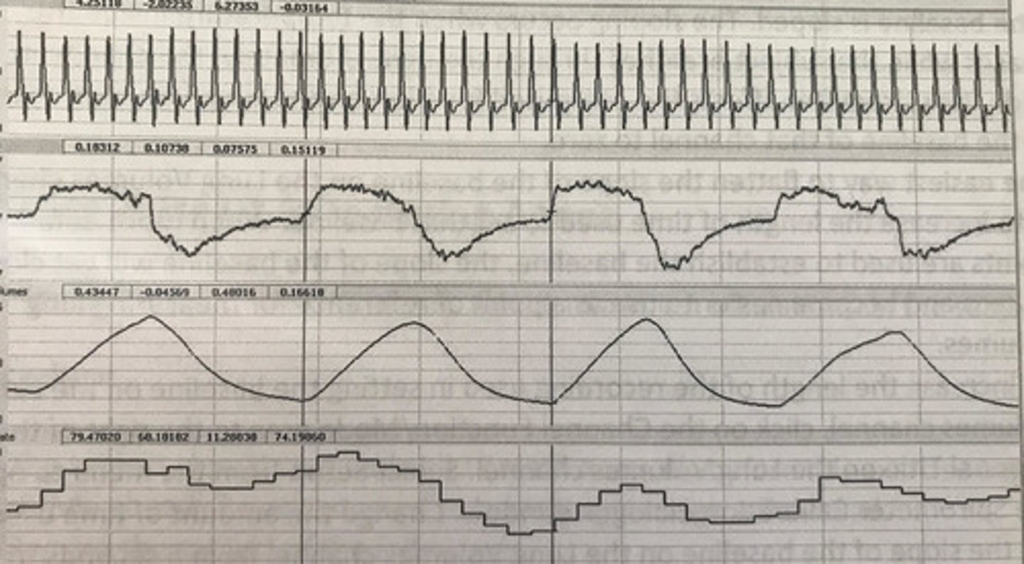 <p>From top to bottom what do the graphs represent</p>