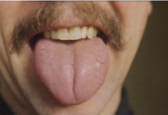 <p>yin deficient or yang deficient tongue?</p>