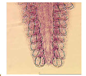 <p>muscular pinching organ</p>