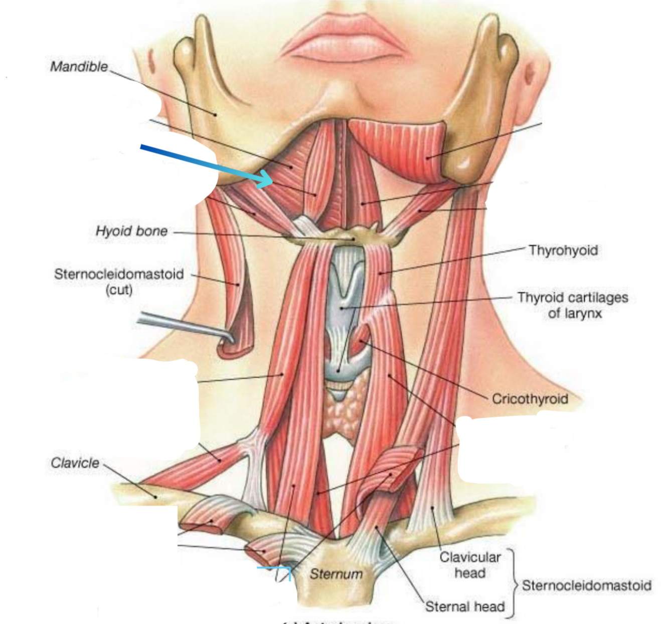 term image