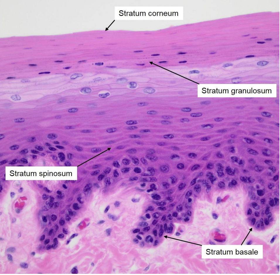 <p>colour diff things by diff amounts</p><p>• "Standard" Haematoxylin and Eosin (H&amp;E) • Haematoxylin (purple/blue) can be considered a basic dye. It binds to acids e.g. nucleic acids (so stains nuclei blue) • Eosin (pink/red) is an acidic dye. It binds to bases, e.g. most proteins in the cytoplasm are basic</p>