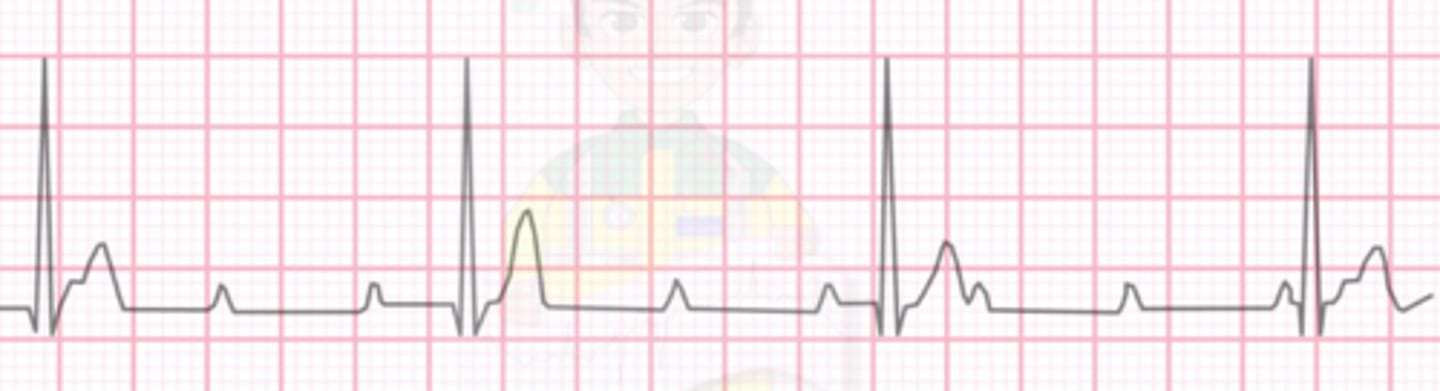 <p>Name the rhythm</p>