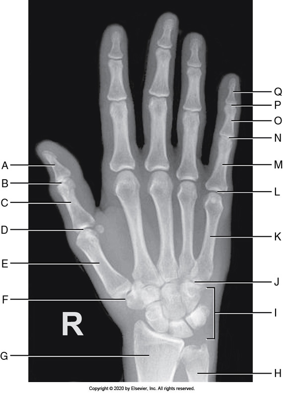 <p>Identify the labeled "B" anatomy below:</p><p>Interphalangeal joint</p><p></p><p>Metacarpophalangeal joint</p><p>&nbsp;</p><p>Radius</p><p>&nbsp;</p><p>Carpometacarpal joint</p>