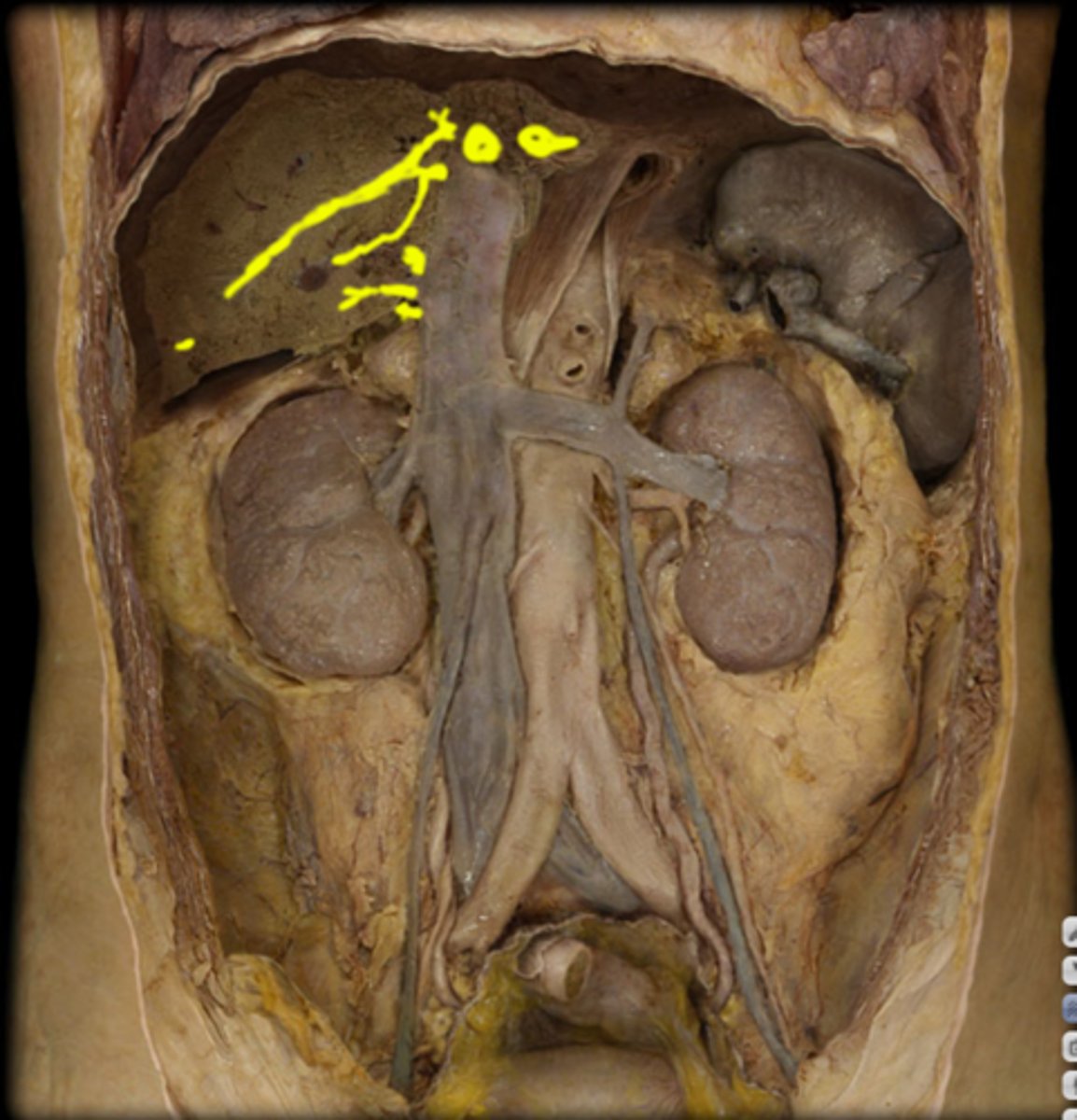 <p>Name these vessels.</p>