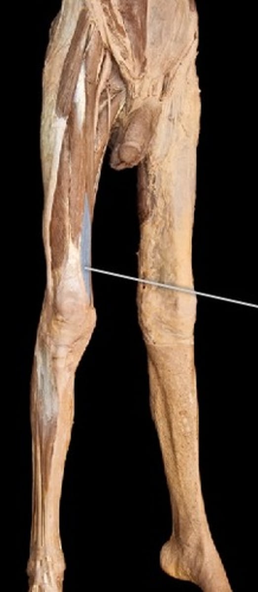 <p>What muscle is this?</p>
