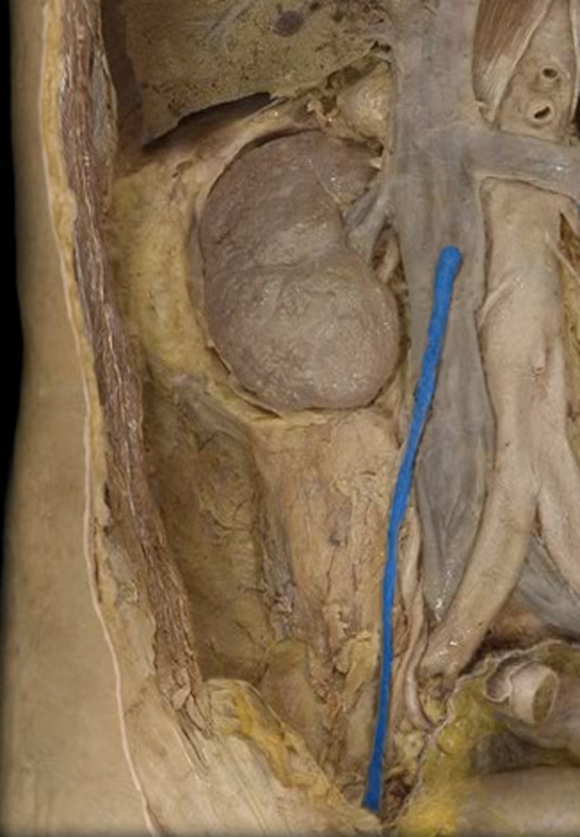 <p>ID, assume pt is female</p>