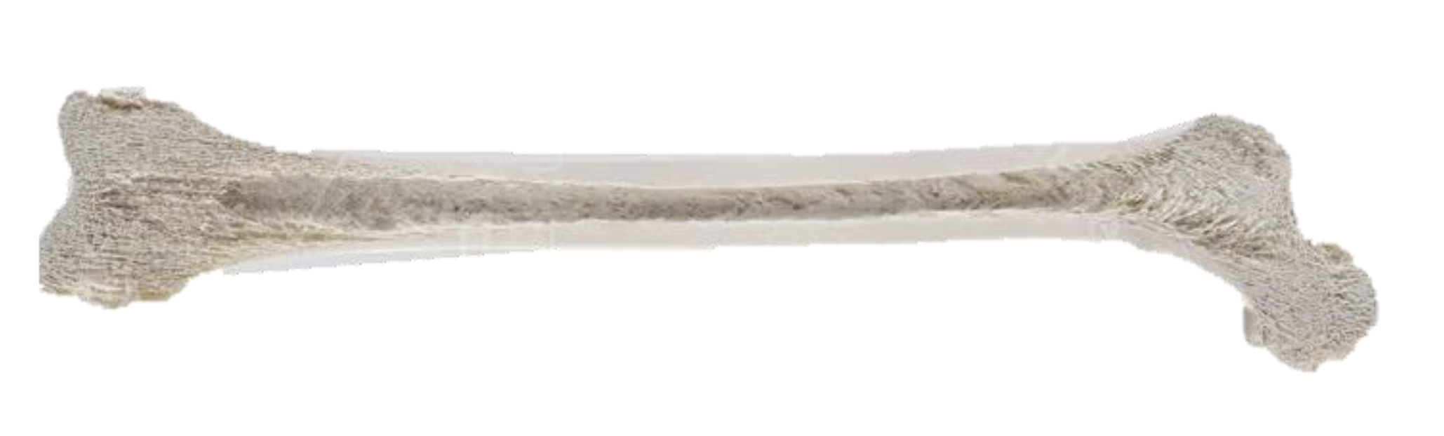 <p>Which Bone Is This?</p>
