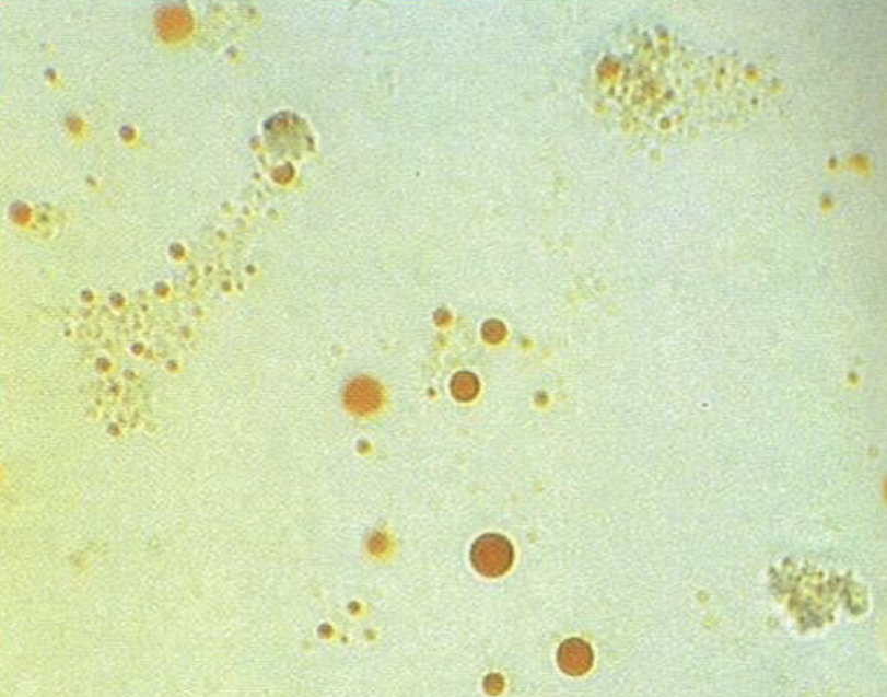 <p>What is this?</p><p>What is the stain used to identify them?</p>