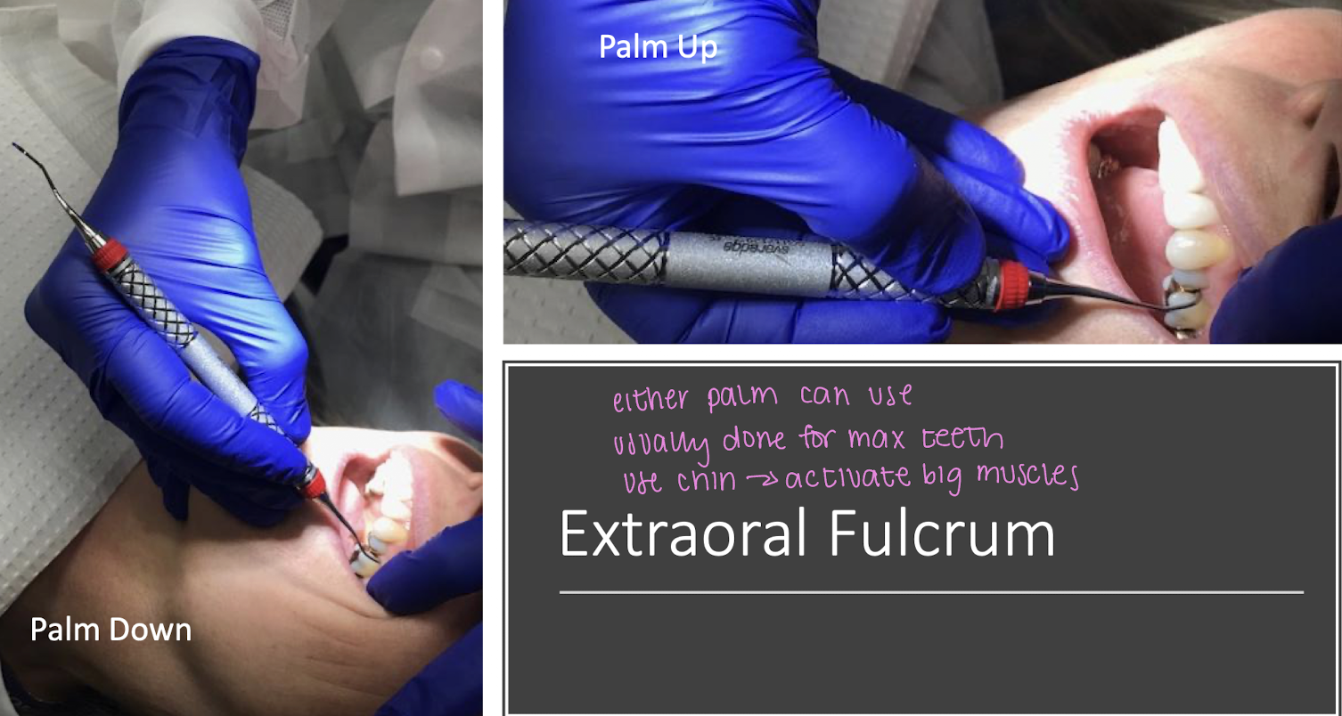 <ul><li><p>palm down </p></li><li><p>palm up </p></li></ul><p></p>