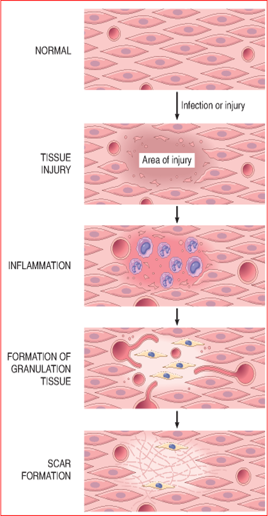 <ol><li><p>Haemostasis Phase/tissue injury: day 0</p></li><li><p>Inflammatory Phase: days 1-2</p></li><li><p>Proliferative Phase: days 3-5</p><ul><li><p>formation of granulation tissue</p></li><li><p>angiogenesis: formation of new blood vessels</p></li></ul></li><li><p>maturation phase: 4-24 days</p><p>or</p><p>secondary intention: scar formation: day 7</p></li></ol><p></p>