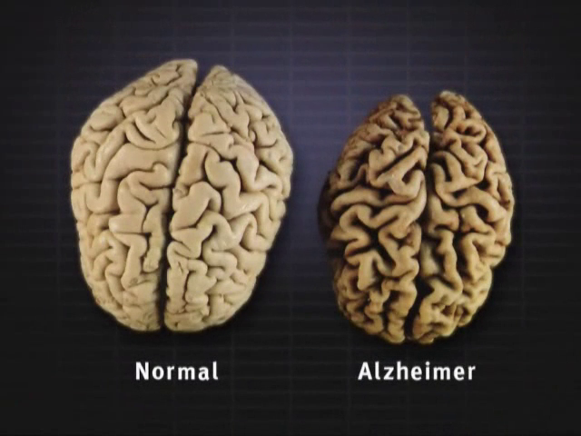 <p>Slowly impair the normal functioning of a person's body</p><ul><li><p>constant</p></li></ul><p></p>