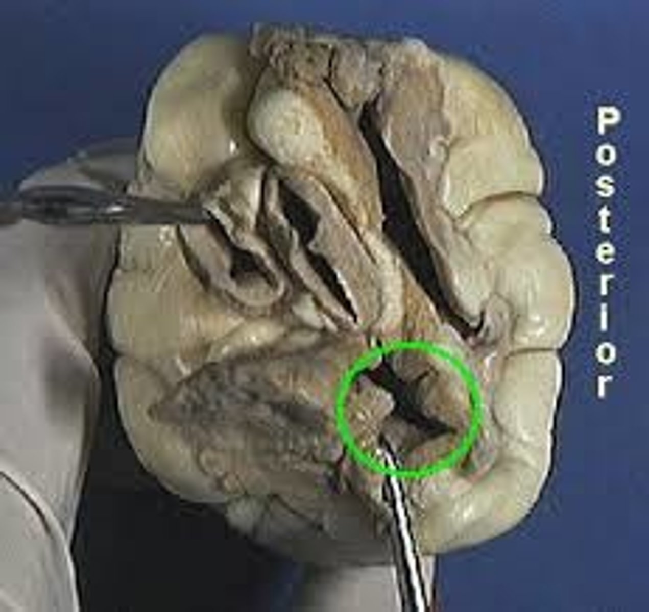 <p>Identify the blood vessel that carries blood from the lungs to the left atrium</p>