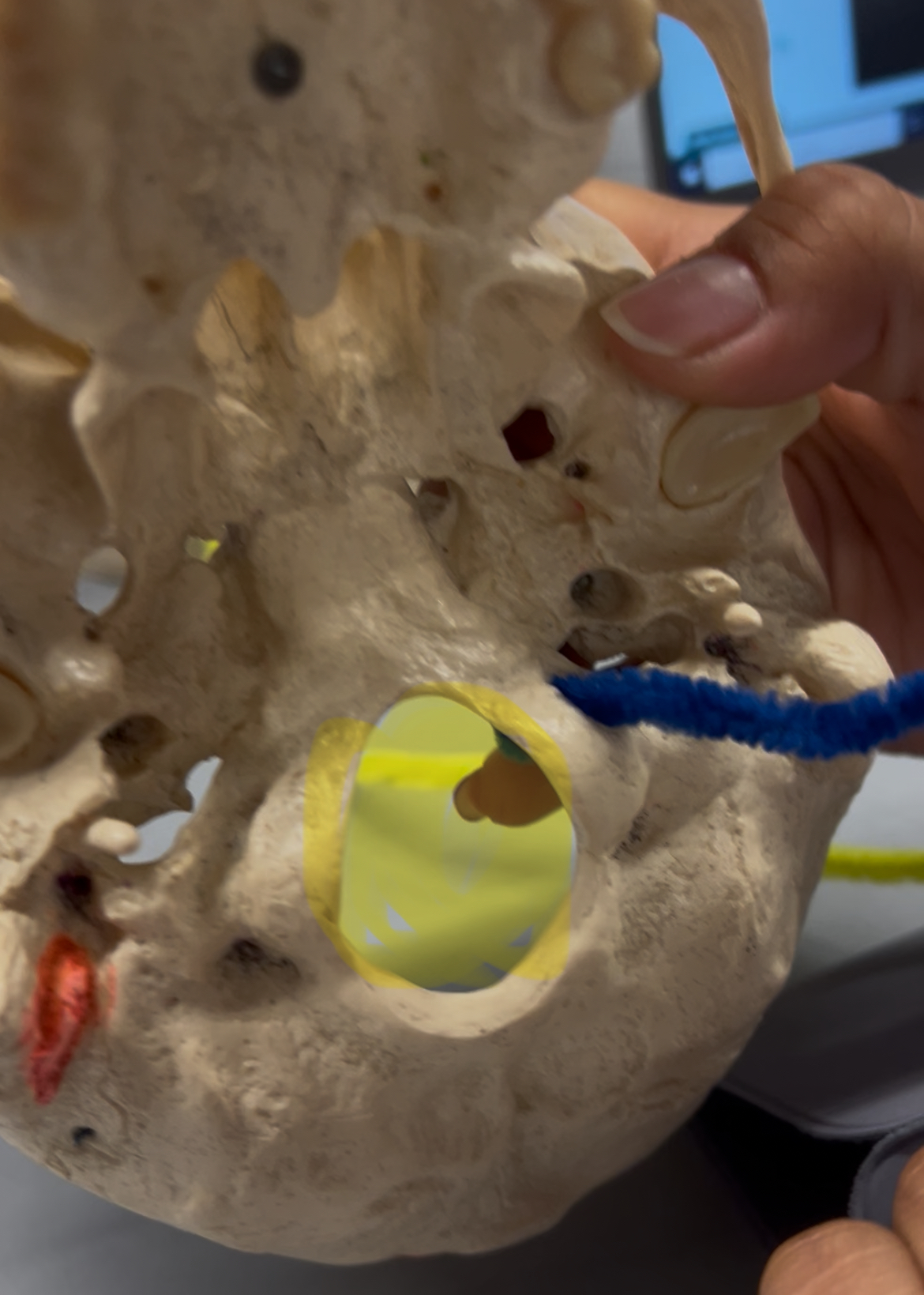 <p>What foramina is labeled by the blue pipe and yellow highlight? What bones are the located? Also, which if any cranial nerves pass through there?</p>