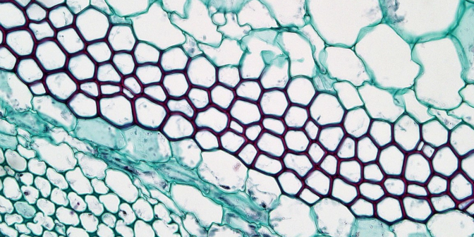 <p>generally located in growing shoot areas (leaves, stems, fruits flowers). these cells have unevenly thickened cell walls and allow for flexible strength and support</p>