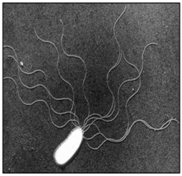 <p><strong>Prokaryote Micrograph: </strong>Flagella</p>