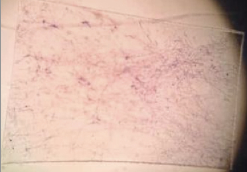 <p>Type of Tissue?</p>