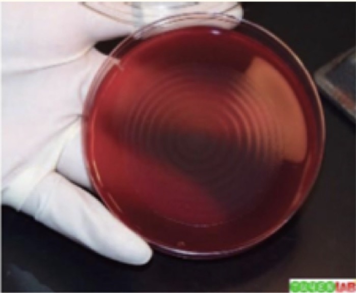 <p>A- identify this media</p><p>B- Give example</p><p>C- Morphological features seen</p><p>D- features under microscope</p><p>E- biochemical reaction</p>