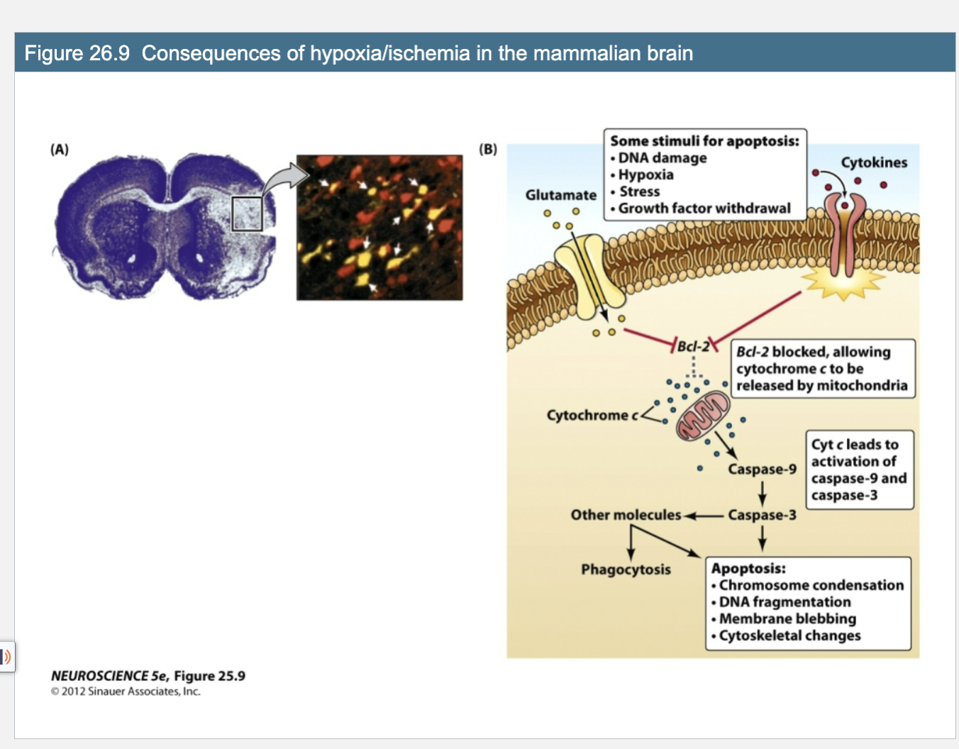 <p>Figure 26.9 Consequences of hypoxia/ischemia in the mammalian brain</p>