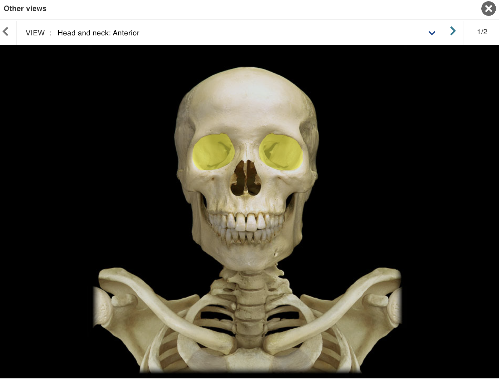 <p>Location:</p><ul><li><p>﻿﻿Skull (anterior)</p></li><li><p>﻿﻿Lateral to nasal cavity</p></li></ul><p class="p1">Description:</p><ul><li><p>﻿﻿Pyramidal space with roof, floor, and medial and lateral walls</p></li><li><p>﻿﻿Roof: frontal and sphenoid bones</p></li><li><p>﻿﻿Floor: palatine and zygomatic bones, and maxilla</p></li><li><p>﻿﻿Lateral wall: zygomatic, sphenoid, and frontal bones</p></li><li><p>﻿﻿Medial wall: ethmoid and lacrimal bones, and maxilla</p></li><li><p>• Openings include superior and inferior orbital fissures, and optic canal</p><p class="p1">Also known as:</p><p class="p1">• Eye socket</p><p class="p1">Comment:</p><p class="p1">• Contains eyeball and its muscles; cranial nerves II, III, IV, V1, and VI; vasculature; lacrimal apparatus; and fat</p></li></ul><p></p>