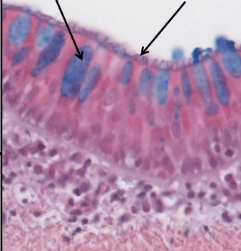 <p>What kind of epithelium (Trachea)</p>