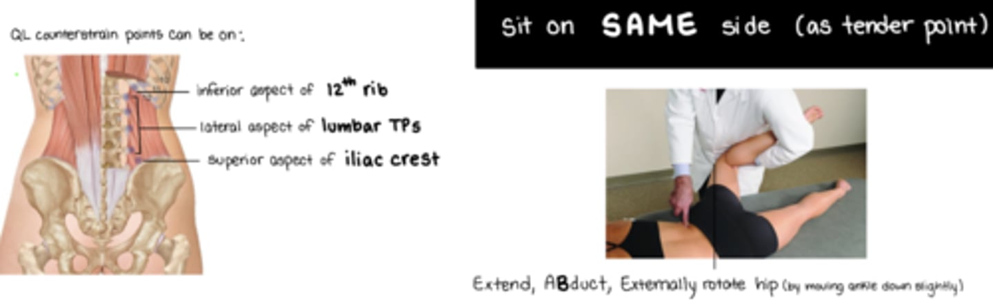 <p>EXTEND, ABDUCT, EXTERNALLY ROTATE HIP</p><p>Stand on SAME SIDE of TP</p><p>QL attachments: inferior aspect of 12th rib, lateral aspect of lumbar TPs, superior aspect of iliac crest</p>
