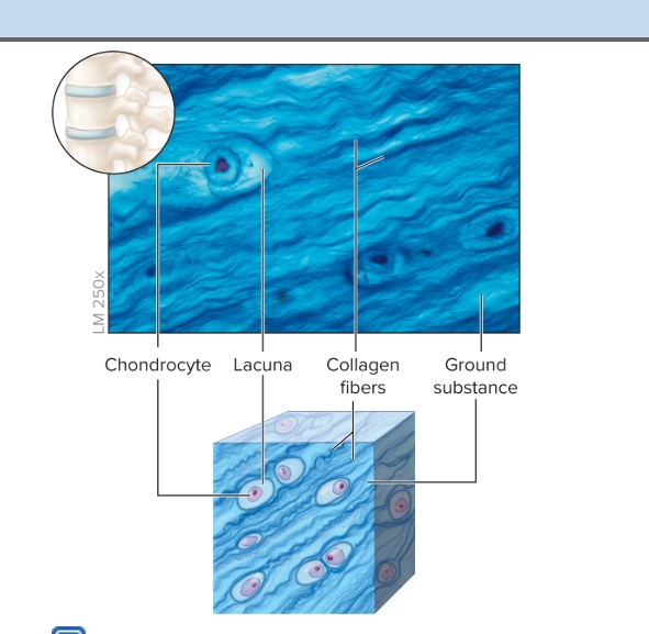 <p>Fibrocartilage</p>