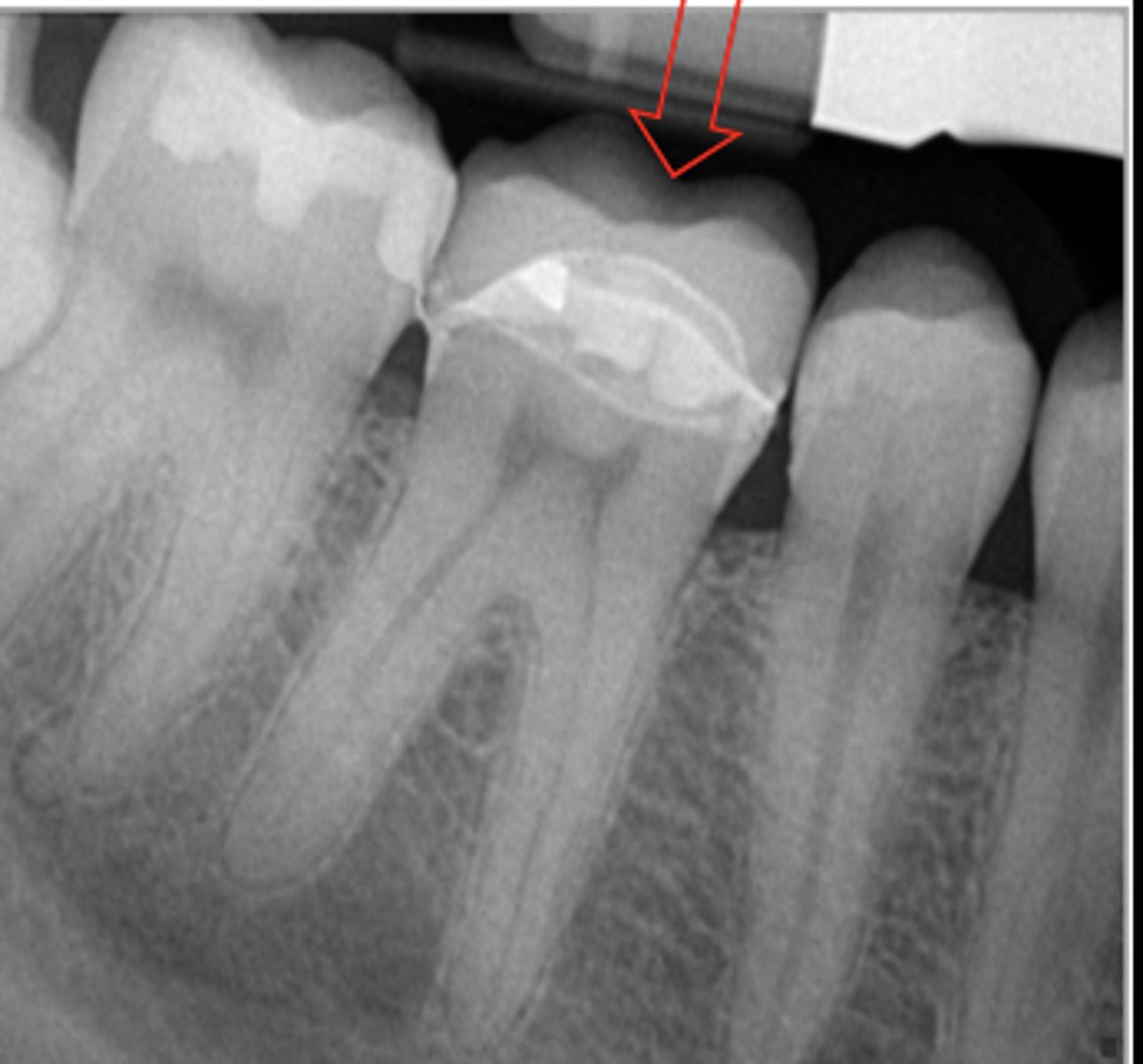 <p>What crown is this?</p>
