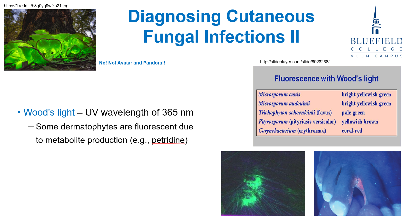 <p>C. Highlights fungal pigments in certain dermatophytes<br></p><p><strong>Wood’s lamp</strong> emits UV light that causes <strong>fluorescence</strong> in some <strong>dermatophytes</strong>, especially those producing <strong>petridine</strong>. It helps confirm <strong>cutaneous fungal infections</strong>.</p>