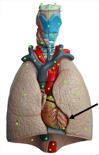 <p>which lung</p>