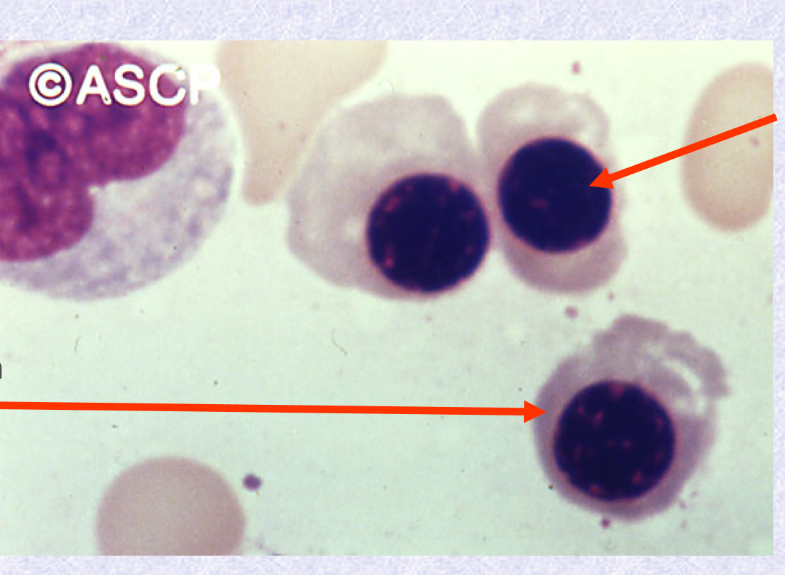 <p>What normoblastic maturation stage is in the image?</p>