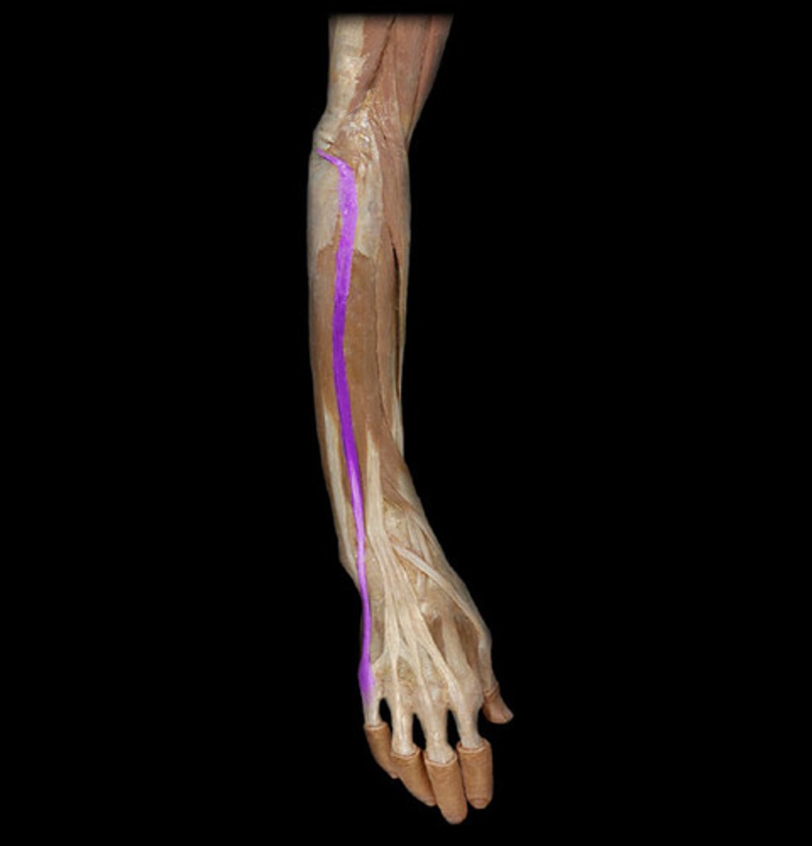 <p>Origin: Lateral epicondyle; Insertion: Middle and distal phalanx of digit 5</p>