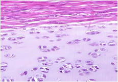 <p>Which cartilage is shown in the following image?</p>