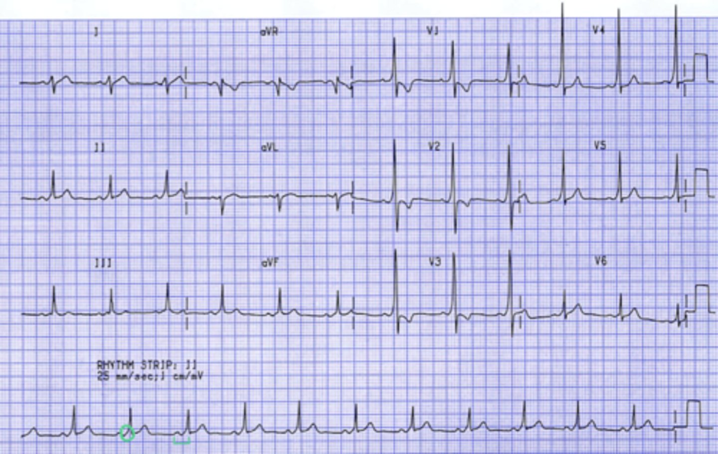 <p>What are the findings</p>