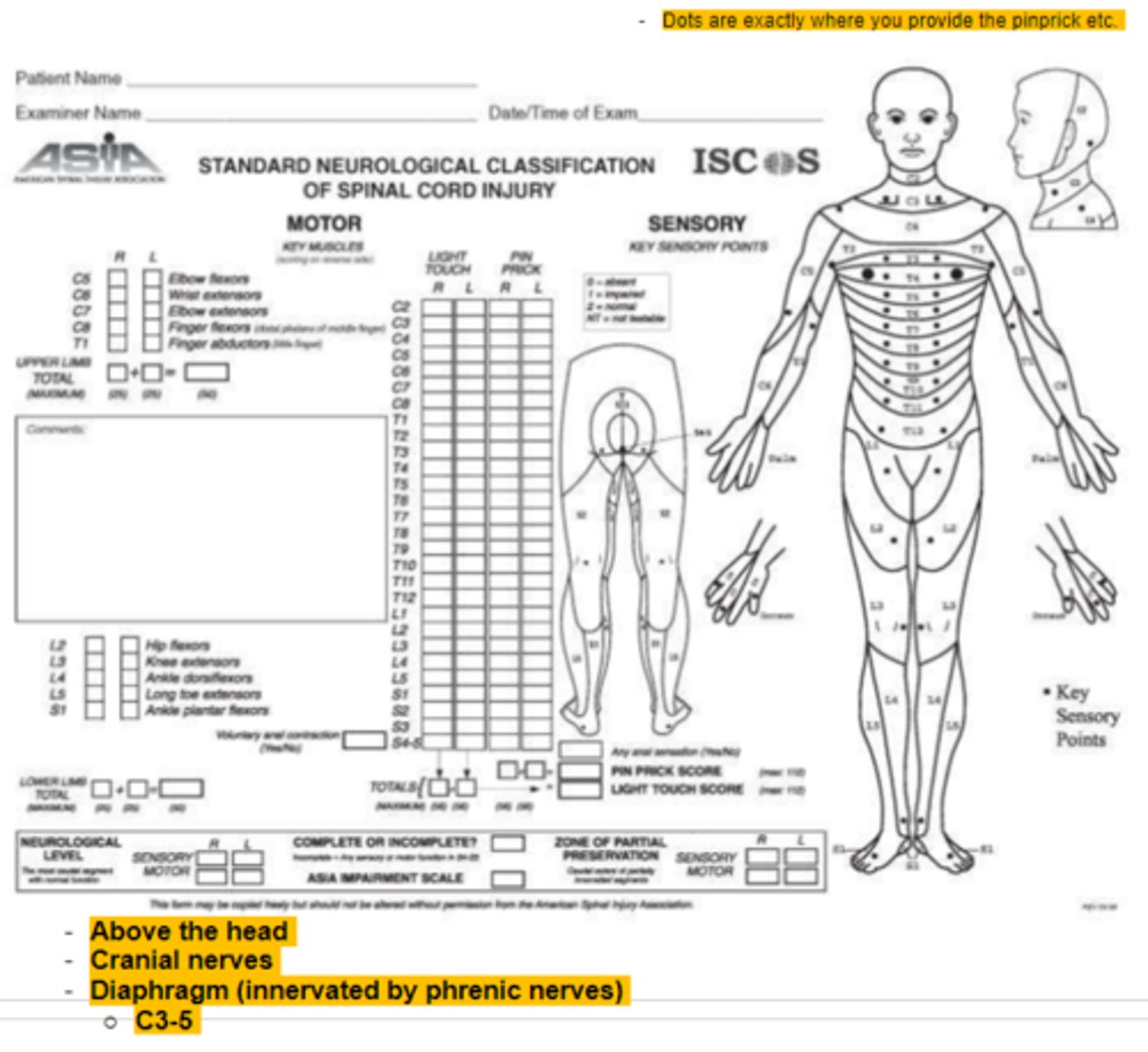 <p>Motor incomplete</p><p>-Motor fxn preserved in most caudal sacral segments for VAC</p><p>OR</p><p>-pt meets criteria for sensory incomplete status (S4-S5 for LT, PP or had DAP</p><p>AND pt has some sparing more than three levels below IL motor level on either side for less than half of key muscles below NLI have muscle grade > or = to 3</p>