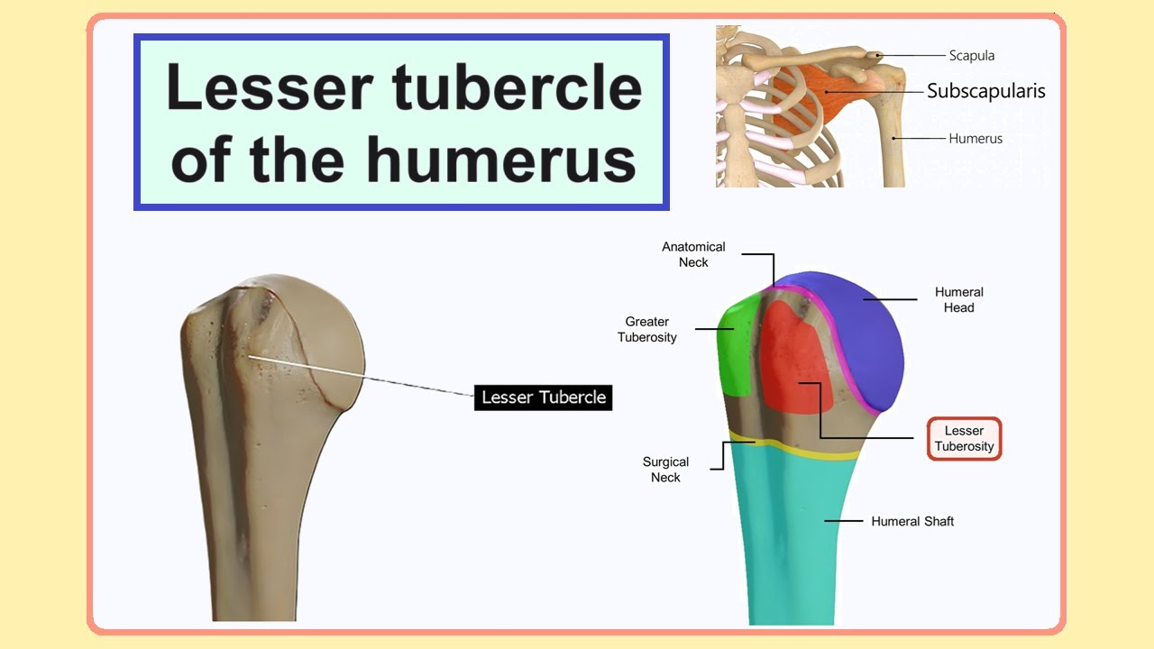 <p>Smaller bump on the front (anterior) of the humerus.</p><p>It serves as a muscle attachment site for the subscapularis muscle. </p>