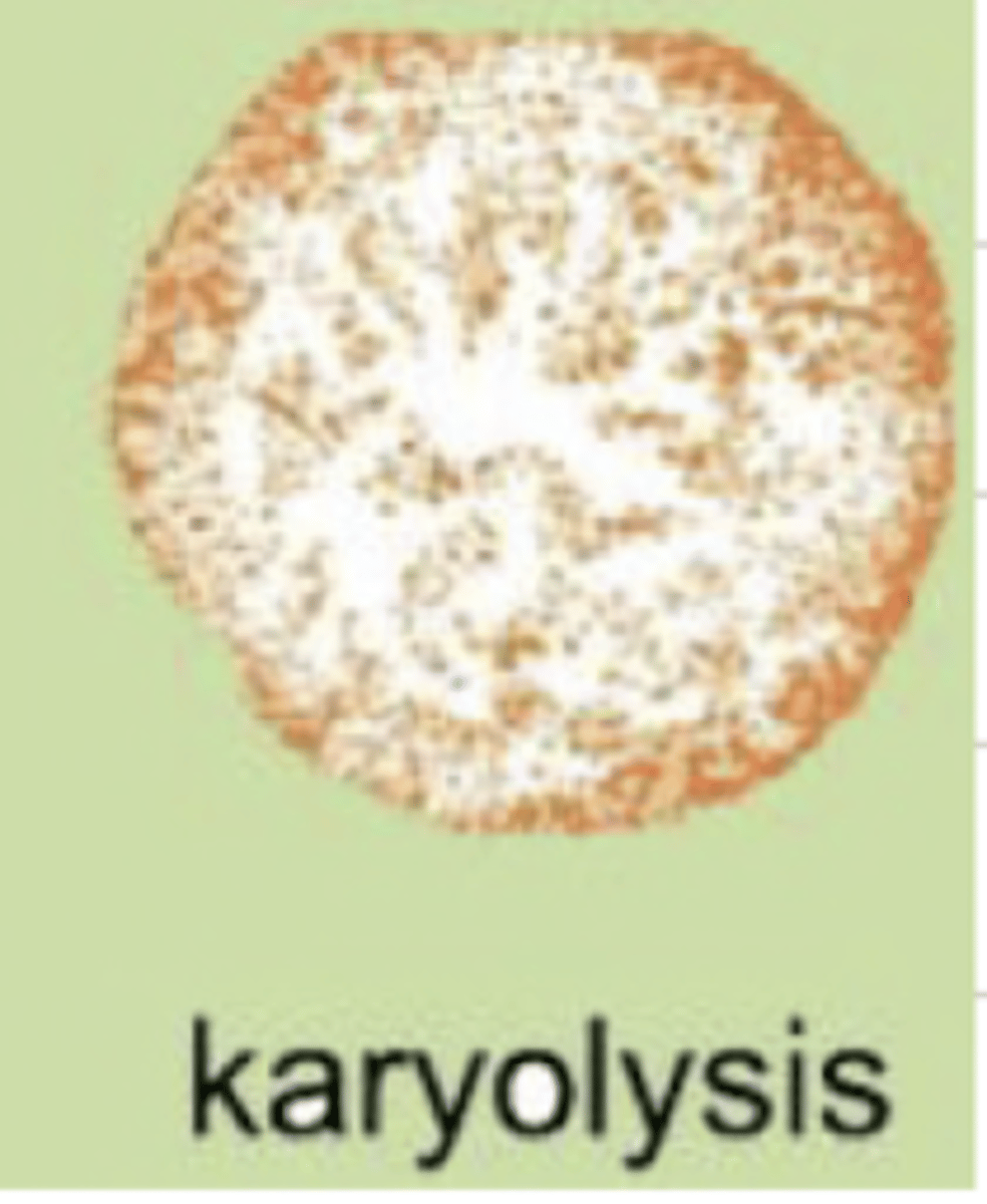 <p>the dissolution of chromatin after cell death. the nucleus is pale and will disappear completely</p>