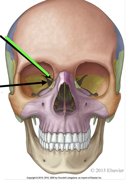 <p>what does the black arrow point to</p>